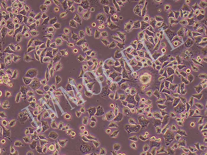 L929-LUC-GFP（小鼠成纖維細(xì)胞-綠色熒光蛋白）圖片