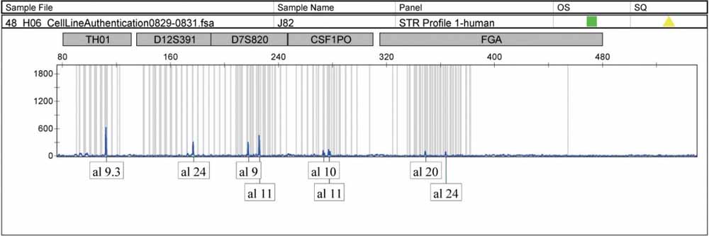 J82人膀胱移行細(xì)胞癌.jpg