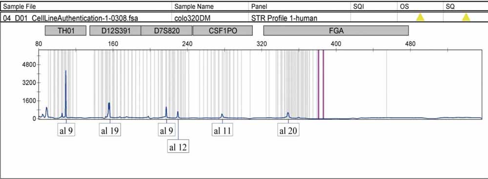 COLO 320DM人結(jié)直腸腺癌細(xì)胞.jpg