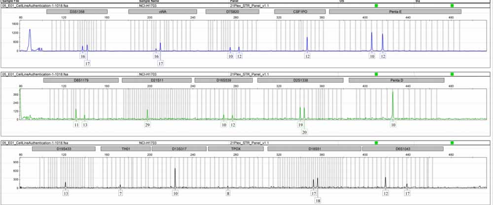 NCI-H1703人肺鱗癌細(xì)胞.jpg