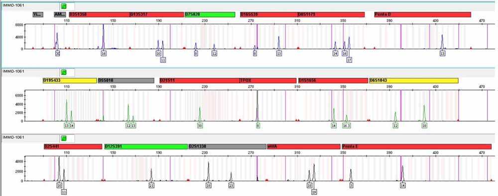 NCI-H520人肺鱗癌細(xì)胞.jpg