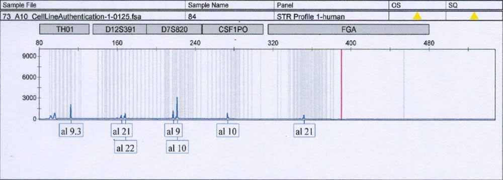 FTC-133人濾泡狀甲狀腺癌細(xì)胞.jpg