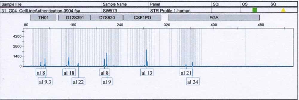 SW579人甲狀腺鱗癌細(xì)胞.jpg