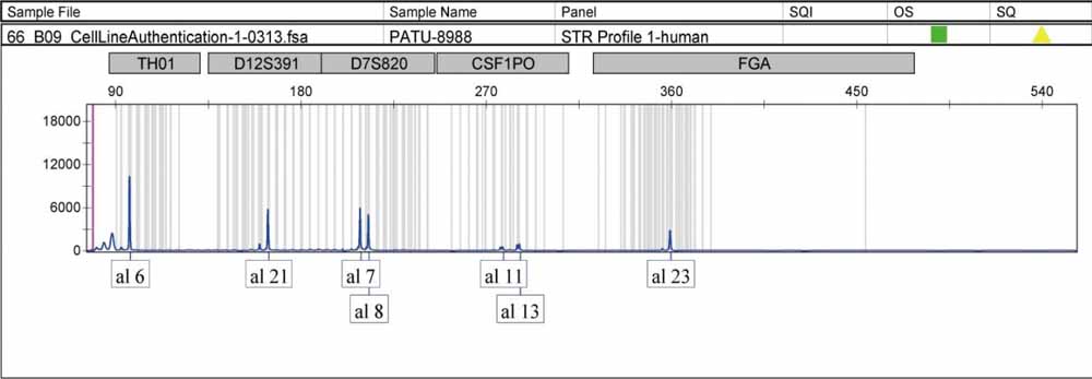 PATU 8988t人胰腺癌細(xì)胞.jpg