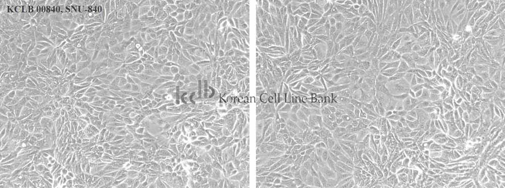 SNU-840人卵巢癌細(xì)胞形態(tài)圖