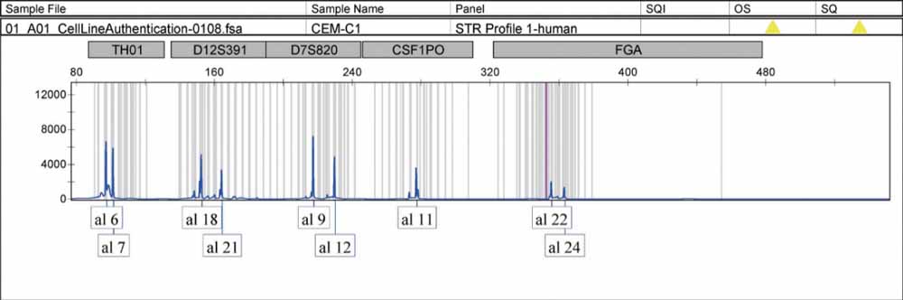 CEMC1人急性淋巴細(xì)胞白血病細(xì)胞.jpg