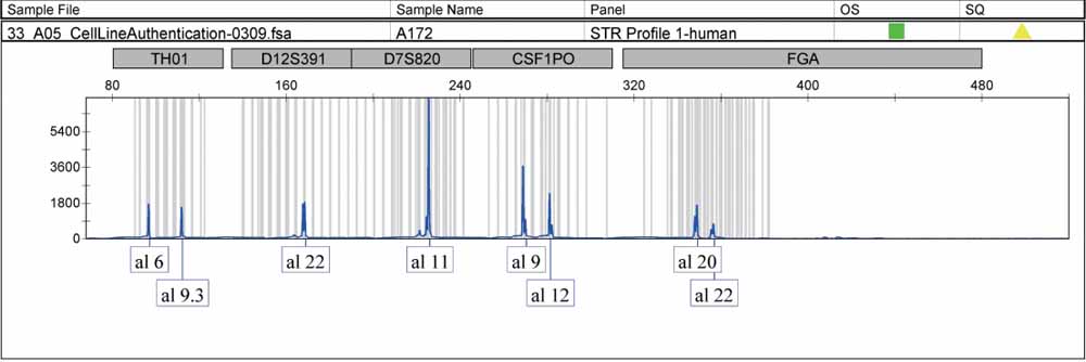 A172人膠質(zhì)母細(xì)胞瘤細(xì)胞.jpg