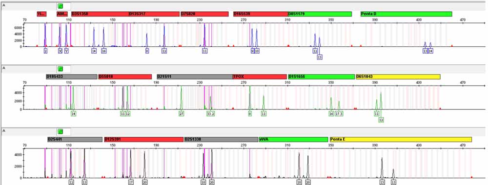 HS 683人腦膠質(zhì)瘤細(xì)胞.jpg