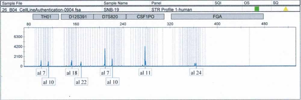 SNB-19人膠質(zhì)瘤細(xì)胞.jpg