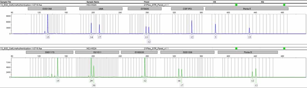 NCI-H524人非小細(xì)胞肺癌細(xì)胞.jpg