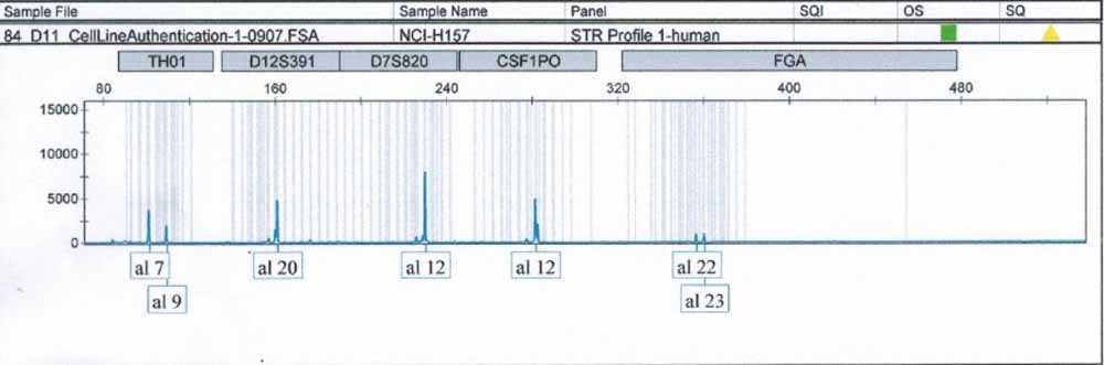 NCI-H157人非小細(xì)胞肺腺癌細(xì)胞.jpg