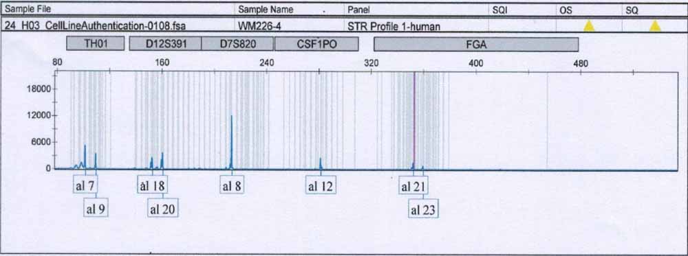 WM-115人惡性黑色素瘤細(xì)胞.jpg