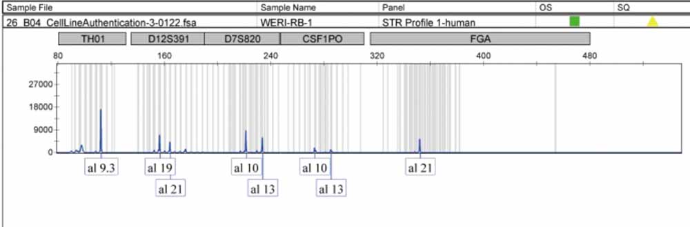 WERI-RB-1人視網(wǎng)膜神經(jīng)膠質(zhì)瘤細(xì)胞.jpg