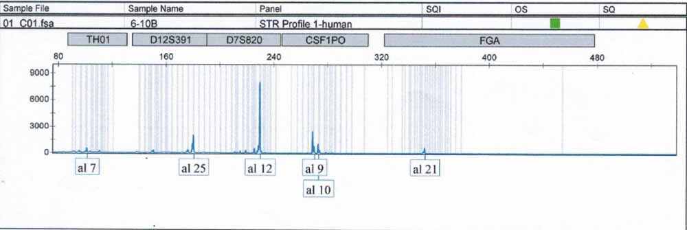 SBC-2人小細胞肺癌細胞.jpg