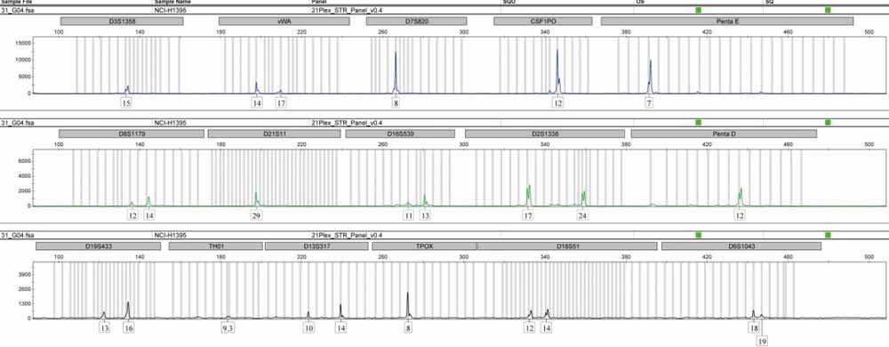 NCI-H1395人肺腺癌細胞.jpg