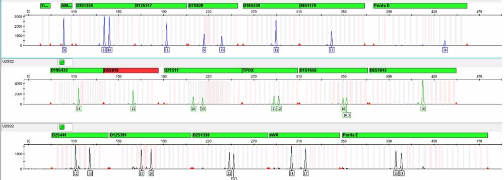 U2932人B淋巴細(xì)胞瘤細(xì)胞.jpg