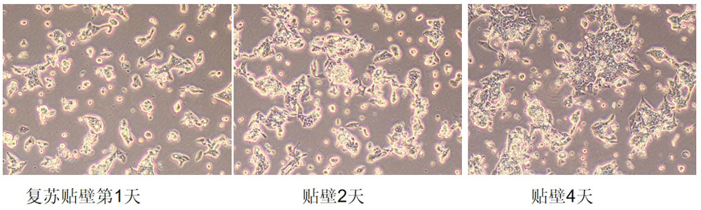 LOVO人結腸癌細胞復蘇培養(yǎng)圖