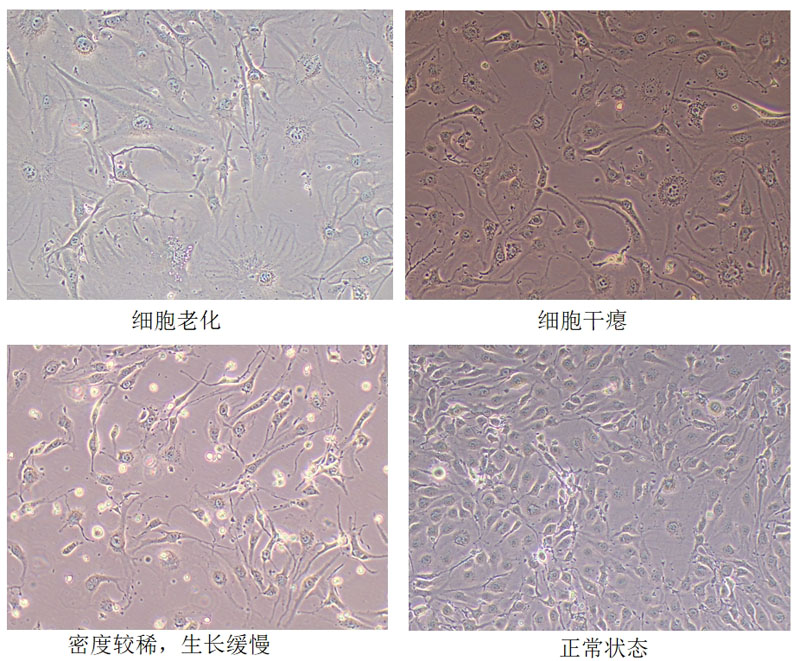 BEND.3小鼠微血管內(nèi)皮細(xì)胞形態(tài)圖