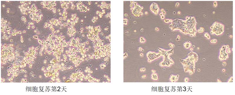 NK92細(xì)胞復(fù)蘇圖片