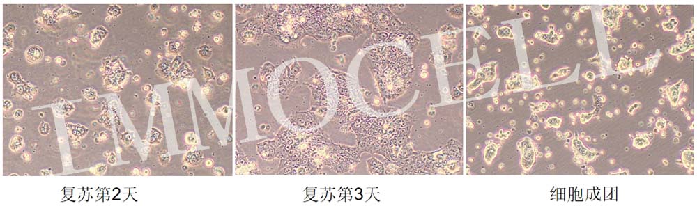 RL95-2人子宮內(nèi)膜癌細(xì)胞復(fù)蘇圖片
