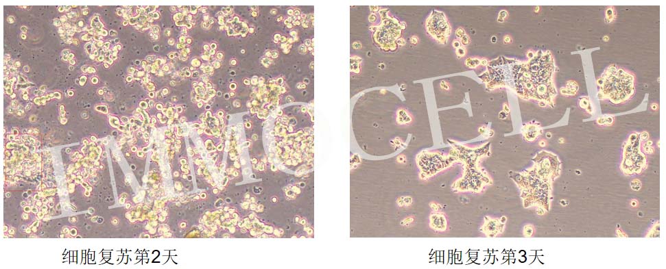 BT474人乳腺導(dǎo)管癌細(xì)胞復(fù)蘇圖片