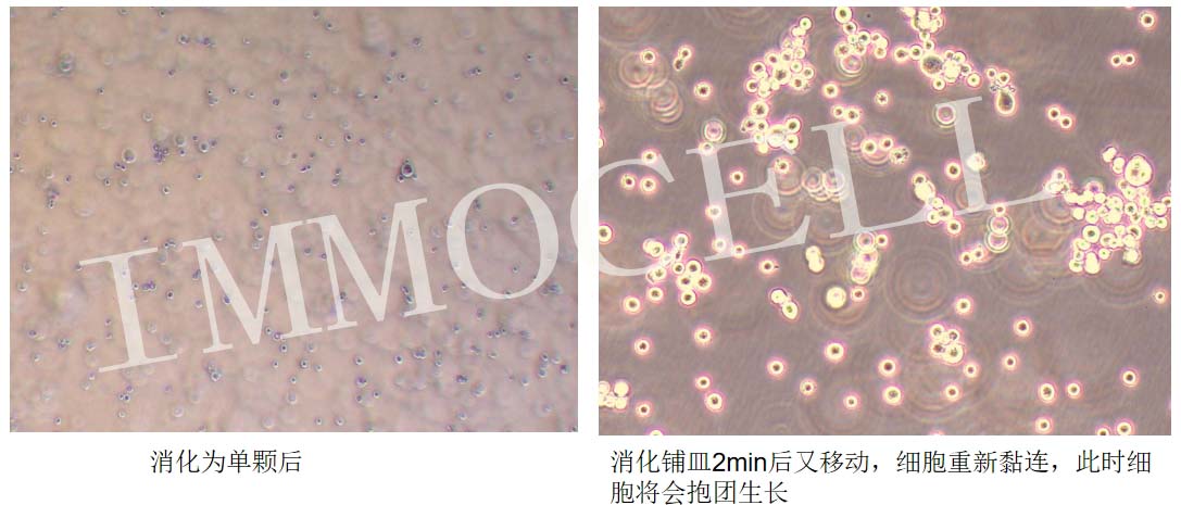 PANC-1人胰腺癌細胞消化后抱團圖片
