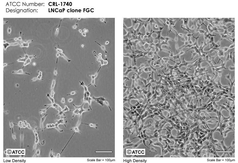 LNCaP clone FGC人前列腺癌細(xì)胞atcc形態(tài)圖片