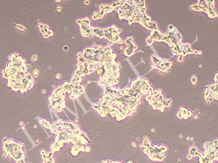 LAPC4人前列腺癌細(xì)胞（STR鑒定）圖片
