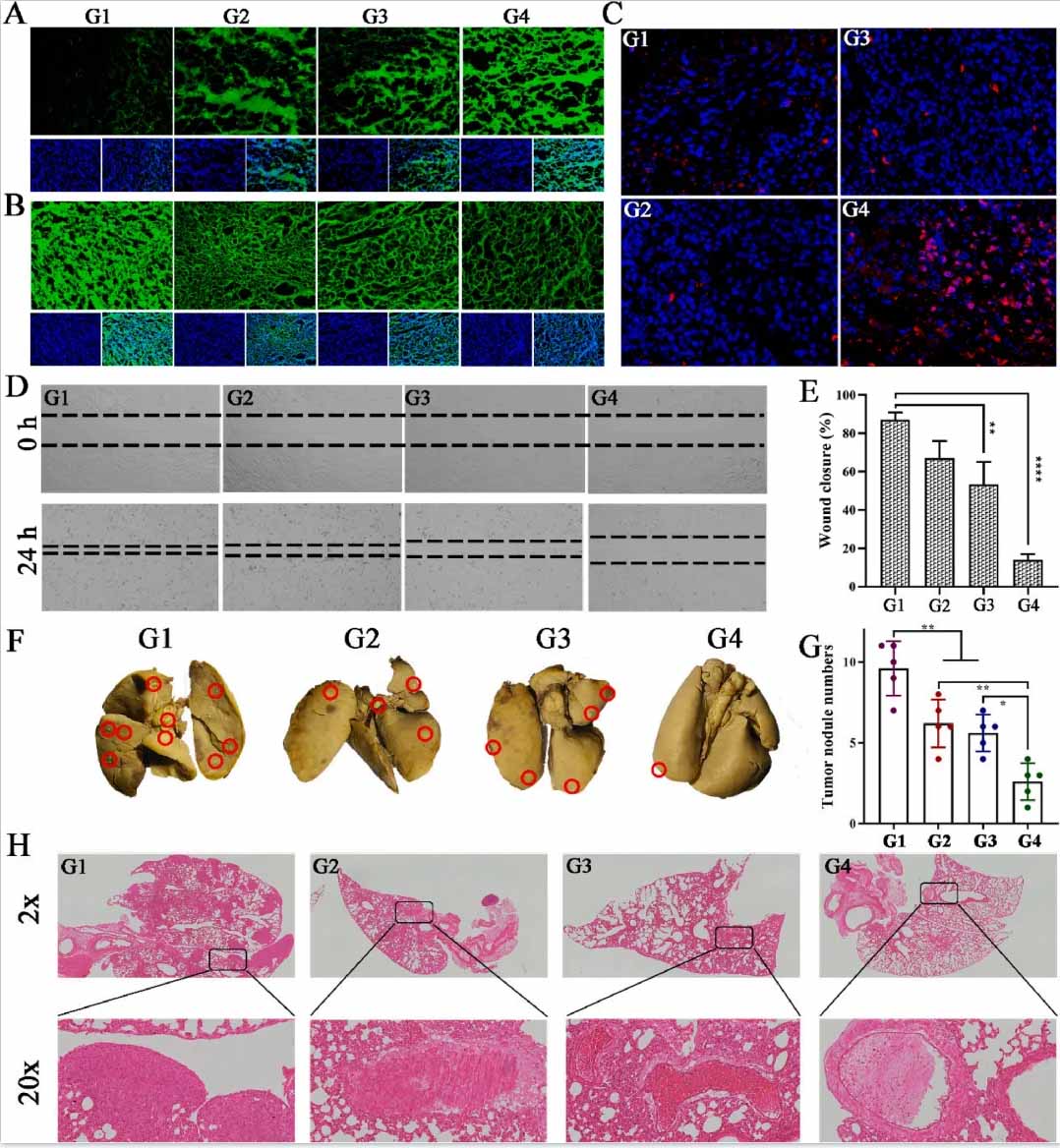 治療后腫瘤切片的ROS生成、GSH水平和Caspase-3免疫熒光圖像。