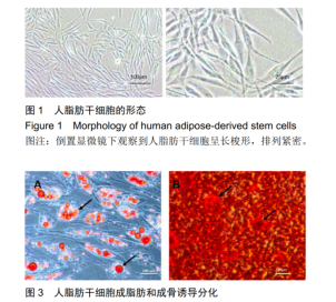 人脂肪間充質干細胞形態(tài)及鑒定圖片