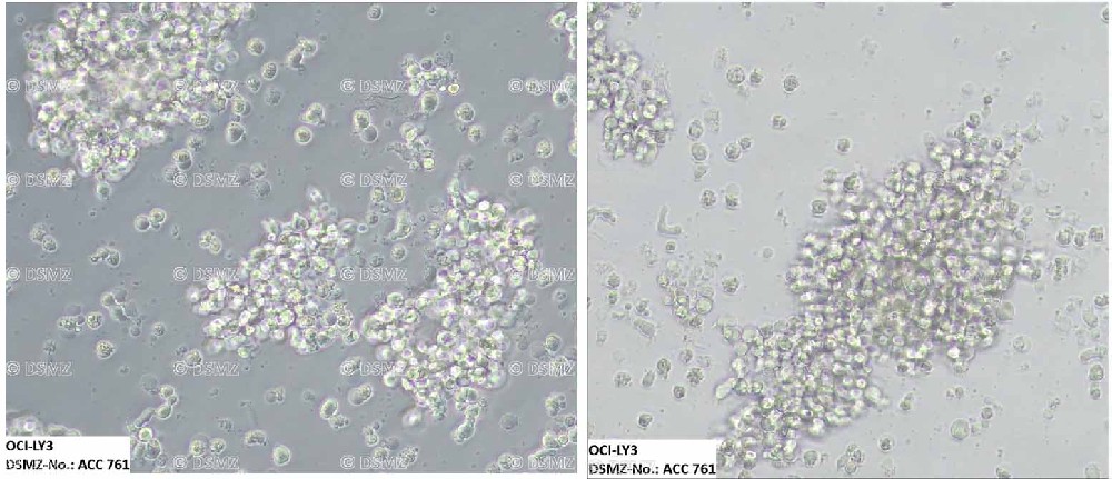 OCI-LY3人彌漫大B細胞淋巴瘤細胞形態(tài)圖片