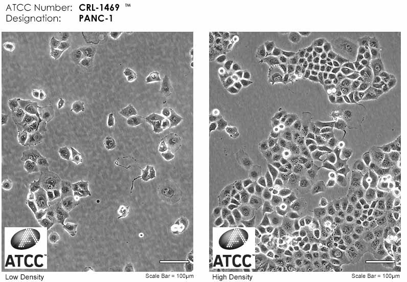 panc1細(xì)胞形態(tài)圖片