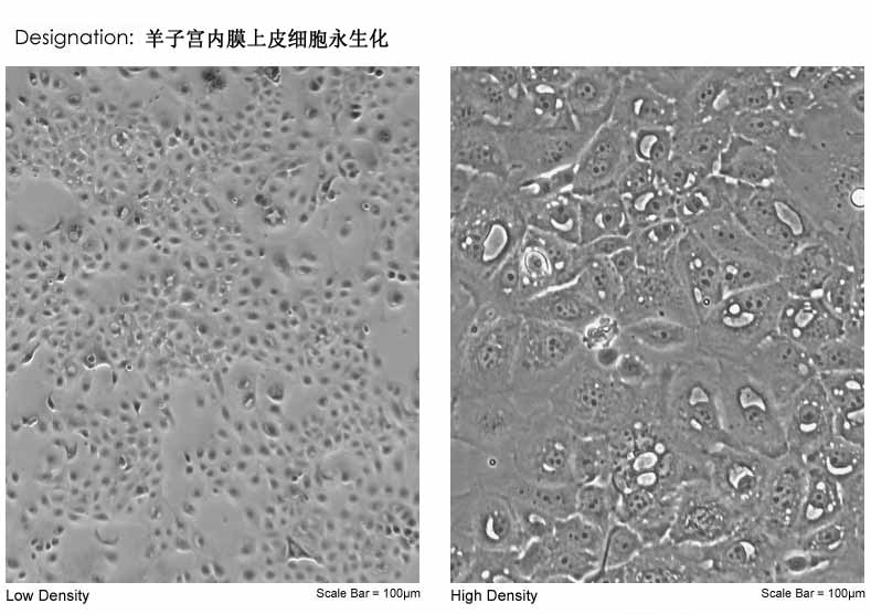 羊子宮內(nèi)膜上皮細(xì)胞永生化形態(tài)圖片