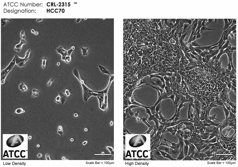 HCC70人乳腺導管癌細胞atcc圖片