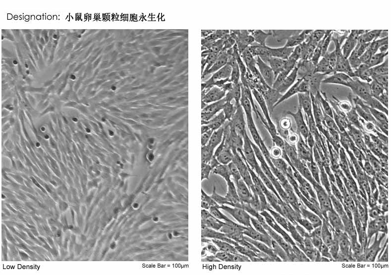 小鼠卵巢顆粒細(xì)胞永生化形態(tài)圖片
