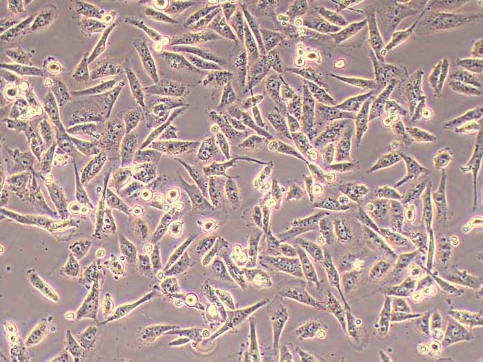 MDA-MB-231/ADR人乳腺癌阿霉素耐藥細(xì)胞株（暫不提供）圖片