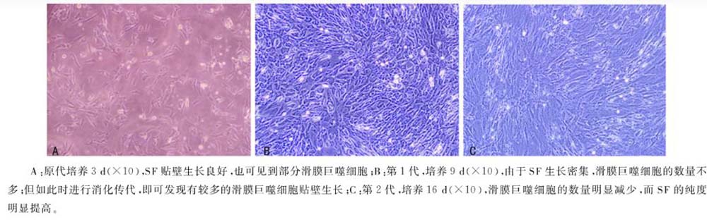 小鼠滑膜成纖維細(xì)胞形態(tài)學(xué)鑒定圖片