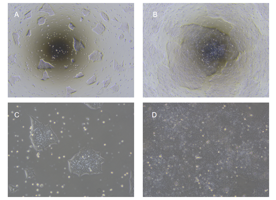 hESC/iPSC完全培養(yǎng)基連續(xù)培養(yǎng)hiPSC-CAS9 細胞形態(tài)圖