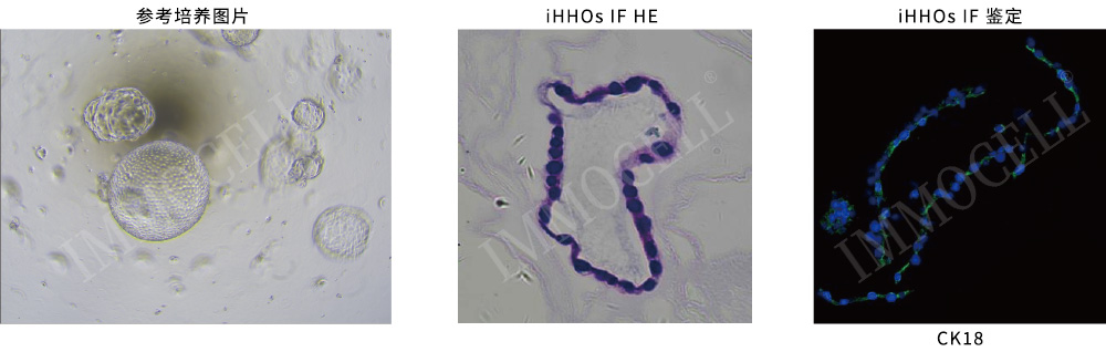 iHHOs為hiPSC誘導(dǎo)分化肝類器官鑒定結(jié)果圖片