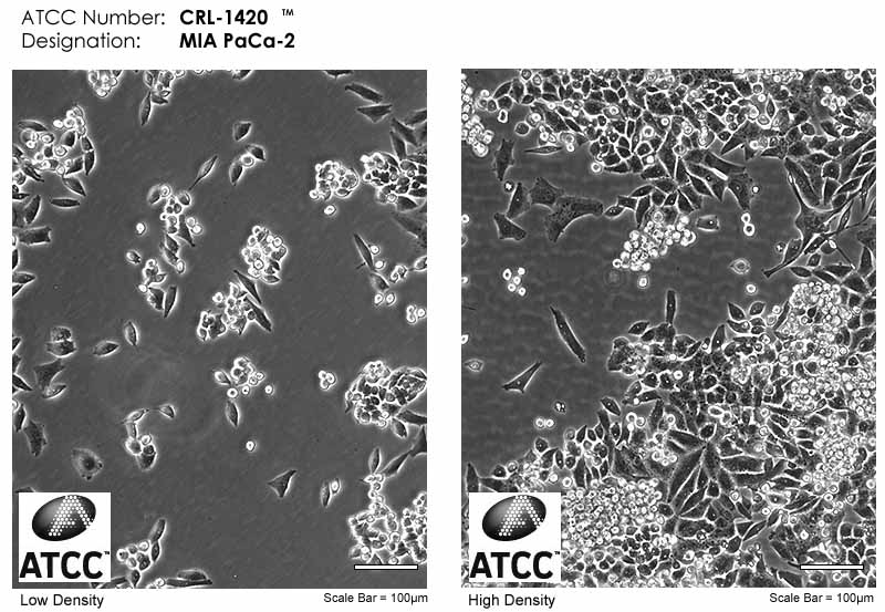 MIA-PACA-2人胰腺癌細(xì)胞形態(tài)圖片