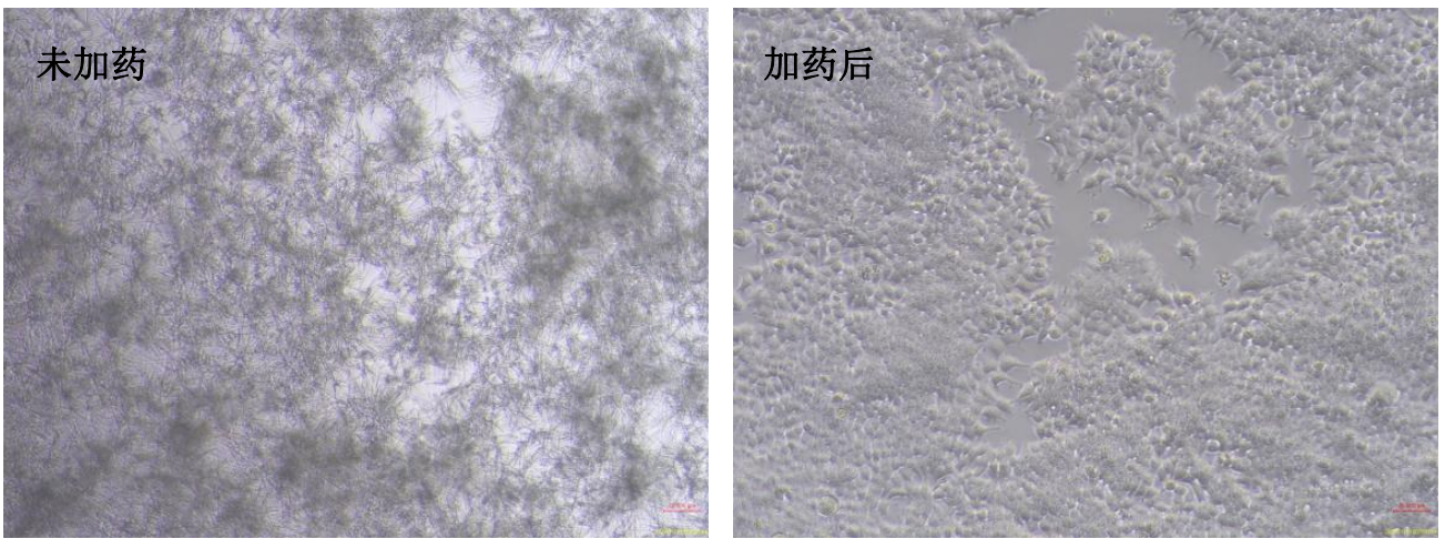 真菌清除劑產(chǎn)品效果圖1