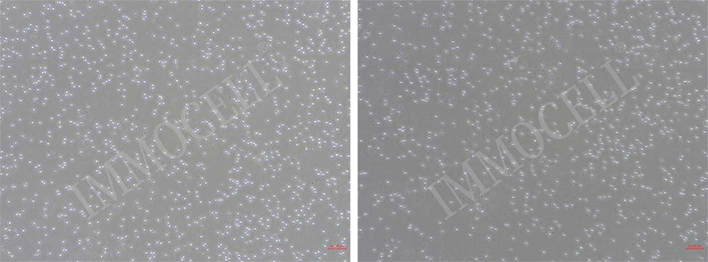 小鼠脾臟CD8+T細(xì)胞形態(tài)圖片